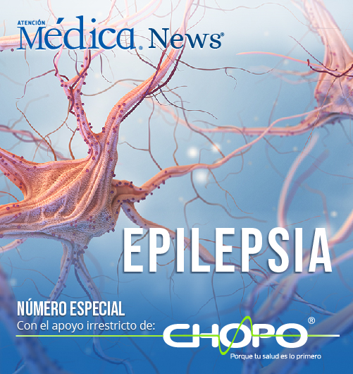 news_chopo_epilepsia
